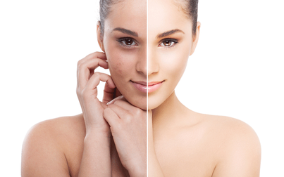 Bí quyết trẻ hóa da mặt tại nhà siêu đơn giản hiệu quả hơn tới spa