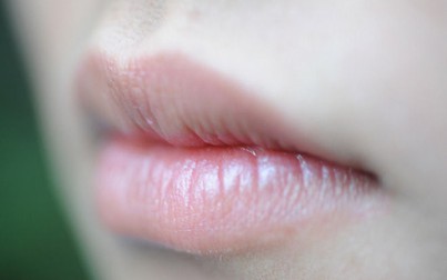 Đôi môi là cửa sổ của sức khỏe: Hãy xem môi bạn cảnh báo bệnh gì để khắc phục sớm