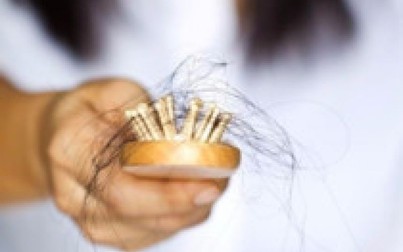 Ăn gì để ngăn ngừa rụng tóc?