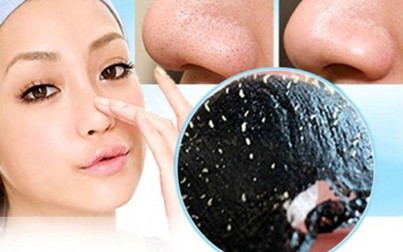 Đi tìm phương pháp trị mụn đầu đen hiệu quả nhất mà không làm tổn hại làn da
