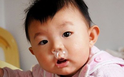 Năm mẹo xử lý khi trẻ bị sổ mũi giúp bé sớm bình phục