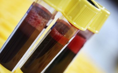 Các nhà khoa học dự đoán được thời gian chết của con người thông qua xét nghiệm máu