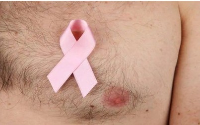 Tại sao nam giới lại mắc bệnh ung thư vú?