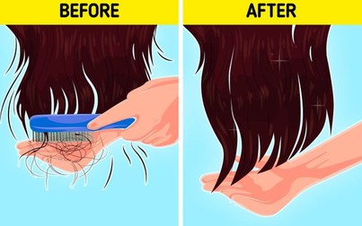 7 cách nhận biết tóc của bạn đang rụng nhiều hơn bình thường