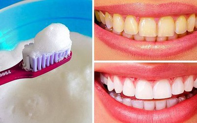 10 cách tốt nhất để làm trắng răng bị ố vàng tại nhà
