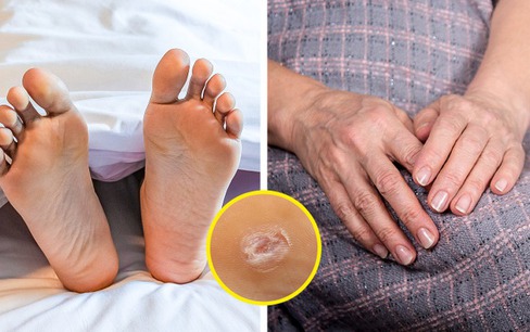 Tại sao nốt ruồi xuất hiện và việc phân loại chúng lại quan trọng