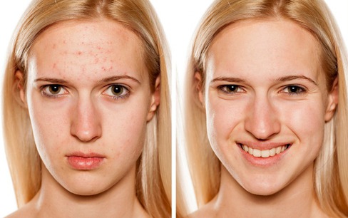 8 mẹo chăm sóc da phổ biến nhưng thực chất rất gây hại