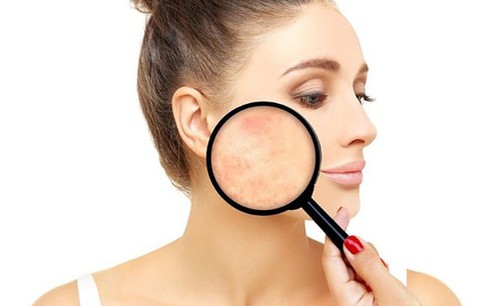 Skin Microbiome - Xu hướng mới của ngành mỹ phẩm chăm sóc da
