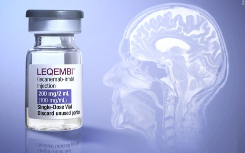 Nhật Bản phê duyệt thuốc điều trị bệnh Alzheimer