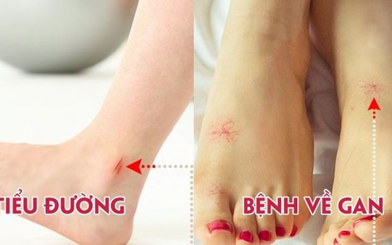 Chỉ cần nhìn chân là biết ngay người đó đang mắc chứng bệnh gì