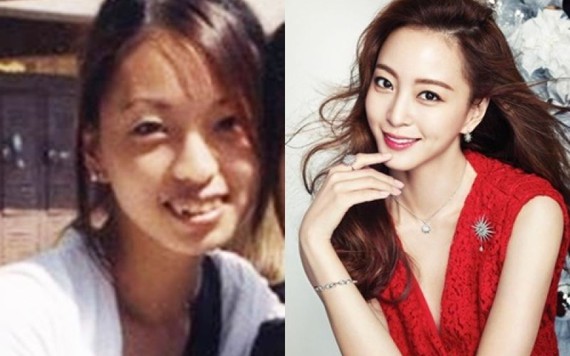 Loạt sao Hàn 'vịt hóa thiên nga' nhờ dao kéo