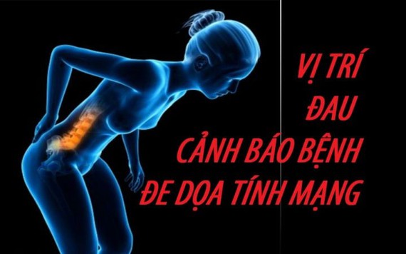 Nếu đau ở vị trí này hãy đi khám ngay vì là dấu hiệu báo bệnh nguy hiểm khôn lường