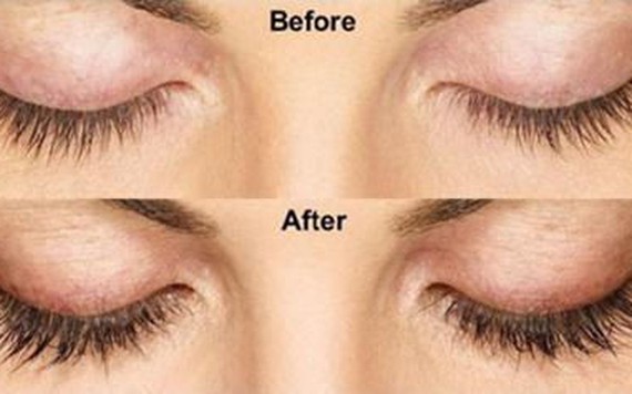 Không dùng mascara bạn vẫn có hàng mi cong vút với công thức cực độc