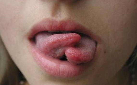 10 xu hướng làm đẹp kỳ lạ nhất mà bạn không thể hiểu được