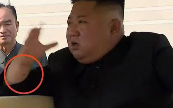 Sức khỏe của ông Kim Jong-un vẫn là một bí ẩn