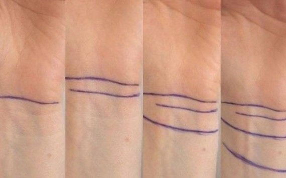 Đường vân trên cổ tay nói lên điều gì?