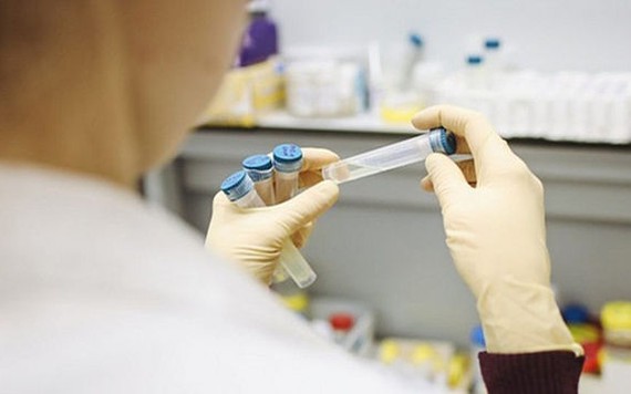 COVID-19: Tốc độ sản xuất vắc xin của Việt Nam nhanh hơn dự kiến
