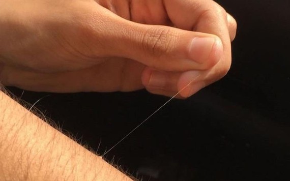 Tại sao cơ thể chúng ta có một số sợi lông mọc dài bất thường?