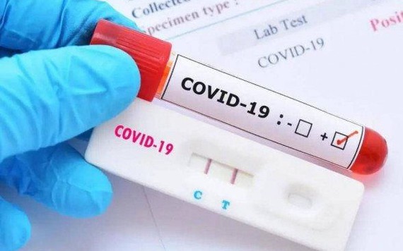 TP.HCM, Kiên Giang kiểm tra đột xuất việc mua bán kit test COVID-19