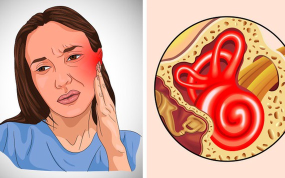 6 dấu hiệu cho thấy bạn bị nhiễm trùng tai và cách phòng ngừa chúng