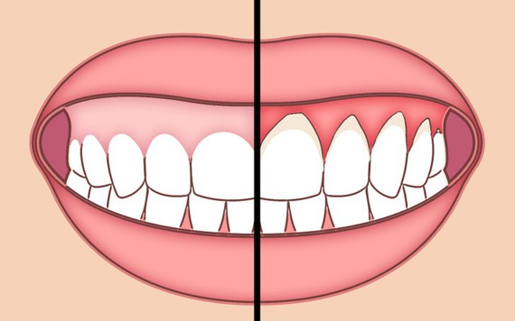 Áp dụng 6 thói quen này để bảo vệ sức khỏe răng miệng